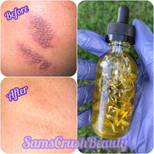 Load image into Gallery viewer, Scar and Stretch Mark Oil
